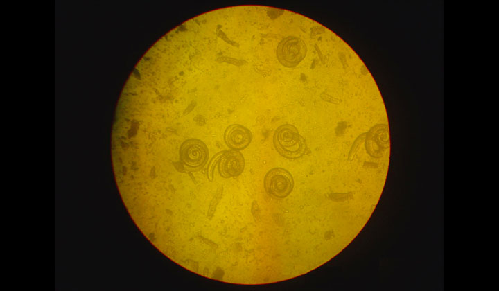 Trichinella al microscopio Trichinella al microscopio